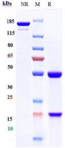 Anti-human PCSK9 (Schering patent Anti-PCSK9 Biosimilar)