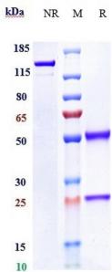 Anti-human DDR1 / CD167a (Imperial College Anti-DDR1 Biosimilar)