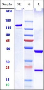 Anti-human FOLH1 / PSMA (PelgifatamAb Biosimilar)