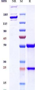 Anti-human IL-2Ra / CD25 (Basiliximab Biosimilar)