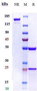 Anti-human ERBB3/ HER3 (Patritumab deruxtecan Biosimilar)