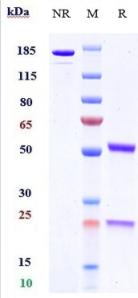 Anti-human Serum Amyloid P / SAP (Dezamizumab Biosimilar)