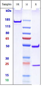 Anti-human TREM2 (PY314 Biosimilar)