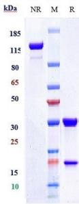 Anti-human CEACAM5 / CEA / CD66e (Tusamitamab Biosimilar)