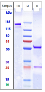 Anti-human MRC2 / CD280 (Quark Patent Anti-Endo180 Biosimilar)