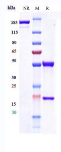 Anti-human IGF1R / CD221 (Figitumumab Biosimilar)