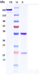 Anti-human IL-13 (M1295 Biosimilar)