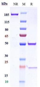 Anti-human Integrin a5b1 (BMS patent Anti-Integrin α5β1 Biosimilar)