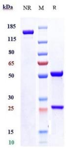 Anti-human SLITRK6 (Sirtratumab Biosimilar)