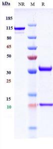 Anti-human ERBB1 / EGFR / HER1 (Nimotuzumab Biosimilar)
