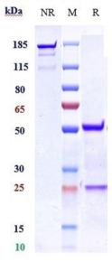 Anti-human GPR44 / PTGDR2 / CD294 (KHK patent Anti-CRTH2 Biosimilar)