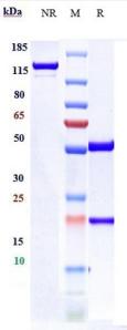 Anti-human NT5E / CD73 (Mupadolimab Biosimilar)