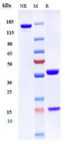 Anti-human MUC1 (Gatipotuzumab Biosimilar)