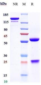 Anti-human TNFSF2 / TNFa (CertolizumAb Biosimilar)