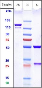 Anti-human FOLR1 / FRA (Mirvetuximab-MMAE Biosimilar)