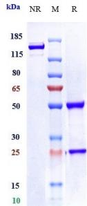 Anti-human LIV-1 / SLC39A6 (Ladiratuzumab Biosimilar)