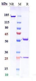 Anti-human Complement C5 (Pozelimab Biosimilar)