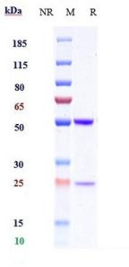IL1B rHu IgG1k mAb (Ref: Canakinumab)