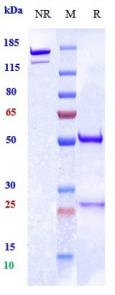 Anti-human PCSK9 (Ralpancizumab Biosimilar)