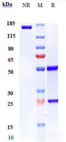 Anti-human VEGFB (CSL346 Biosimilar)