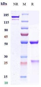 Anti-human PCSK9 (Boehringer Anti-PCSK9 Biosimilar)