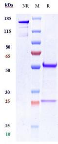 Anti-human CDH11 / Cadherin-11 (RG6125 Biosimilar)
