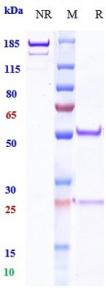 Anti-human PDCD1 / PD-1 / CD279 (Ezabenlimab Biosimilar)
