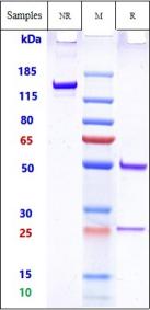 Anti-human 158P1D7 (Agensys patent Anti-158P1D7 Biosimilar)
