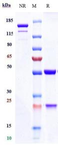 Anti-human TNFSF7 / CD27L / CD70 (Cusatuzumab Biosimilar)
