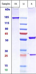 Anti-human TM4SF1 (Beth Israel Patent Anti-TM4SF1 Biosimilar)
