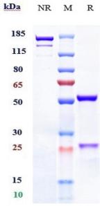 Anti-human TNFSF13B / BAFF / CD257 (Belimumab Biosimilar)