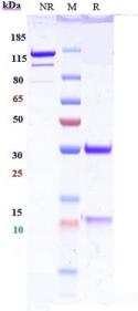 Anti-human IL-13 (Lebrikizumab Biosimilar)