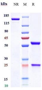 Anti-human SOST / Sclerostin (Blosozumab Biosimilar)