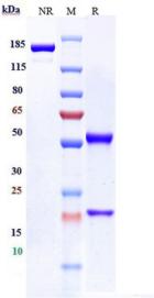 Anti-human B7-H3 / CD276 (Mirzotamab Biosimilar)