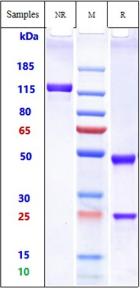 IL2RA/CD25 rHu IgG1k mAb (Ref: Camidanlumab)