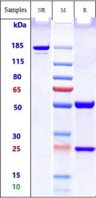 Anti-human Amyloid Alpha (Birtamimab Biosimilar)