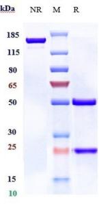 Anti-human B7-H2 / ICOSL / CD275 (Prezalumab Biosimilar)