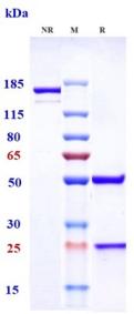 Anti-human NaPi2b / SLC34A2 (Upifitamab Biosimilar)