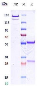 Anti-human CD38 (Felzartamab Biosimilar)