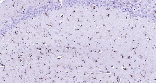 Immunohistochemical analysis of paraffin embedded Mouse brain tissue slide using IHC0101M (Mouse GFAP IHC Kit).