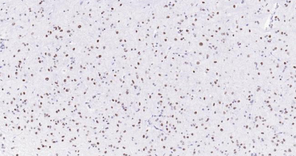 Immunohistochemical analysis of paraffin embedded rat brain tissue slide using IHC0105R (Rat MYBL2 IHC Kit).