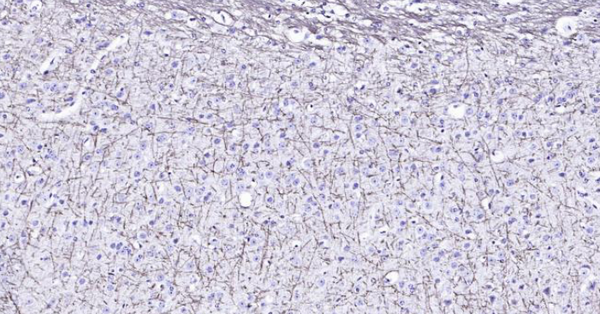 Immunohistochemical analysis of paraffin embedded mouse brain tissue slide using IHC0107M (Mouse MBP IHC Kit).
