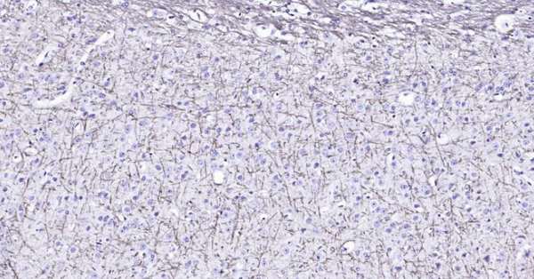 Mouse MBP Ready-To-Use IHC Kit – Bioss