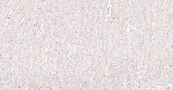 Immunohistochemical analysis of paraffin embedded rat brain tissue slide using IHC0107R (Rat MBP IHC Kit).