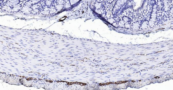 Immunohistochemical analysis of paraffin embedded rat colon tissue slide using IHC0108R (Rat Peripherin IHC Kit).