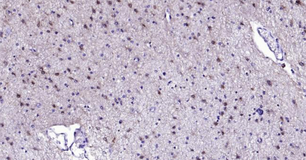 Immunohistochemical analysis of paraffin embedded human brain tissue slide using IHC0110H (Human S100B IHC Kit).