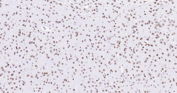 Immunohistochemical analysis of paraffin embedded mouse brain tissue slide using IHC0111M (Mouse Histone H3 IHC Kit).