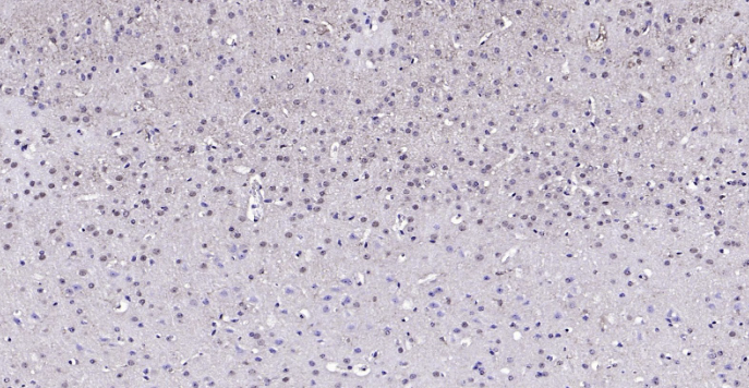 Immunohistochemical analysis of paraffin embedded mouse brain tissue slide using IHC0121M (Mouse GAPDH IHC Kit).
