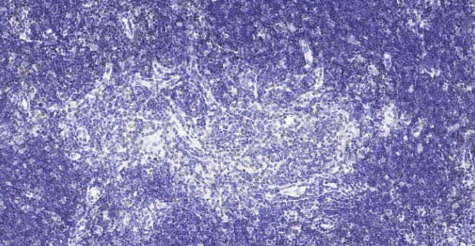 Immunohistochemical analysis of paraffin embedded mouse thymus tissue slide using IHC0123M (Mouse PCNA IHC Kit).