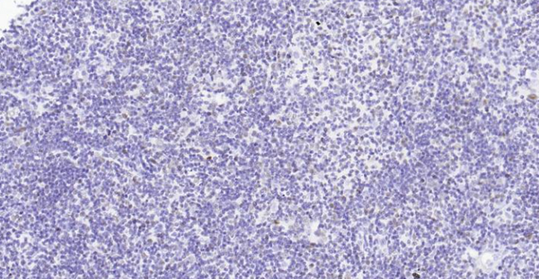 Immunohistochemical analysis of paraffin embedded rat thymus tissue slide using IHC0123R (Rat PCNA IHC Kit).